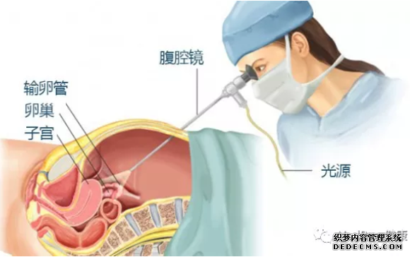泰安温宿县宫外孕的症状表现有哪些